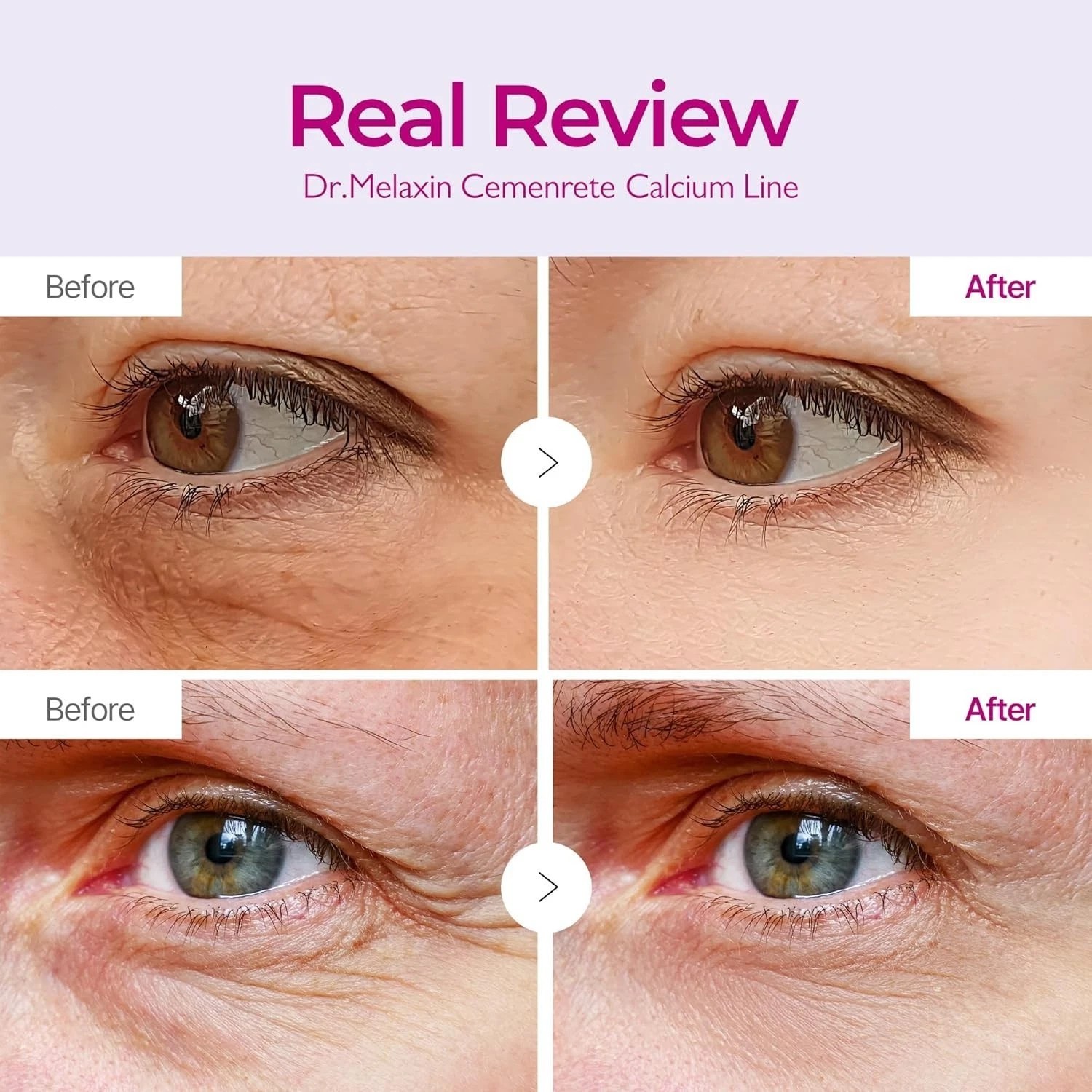 Dr.Melaxin Eye Patch - Cemenrete Calcium Volume - Firming - 60 pcs - Genuine