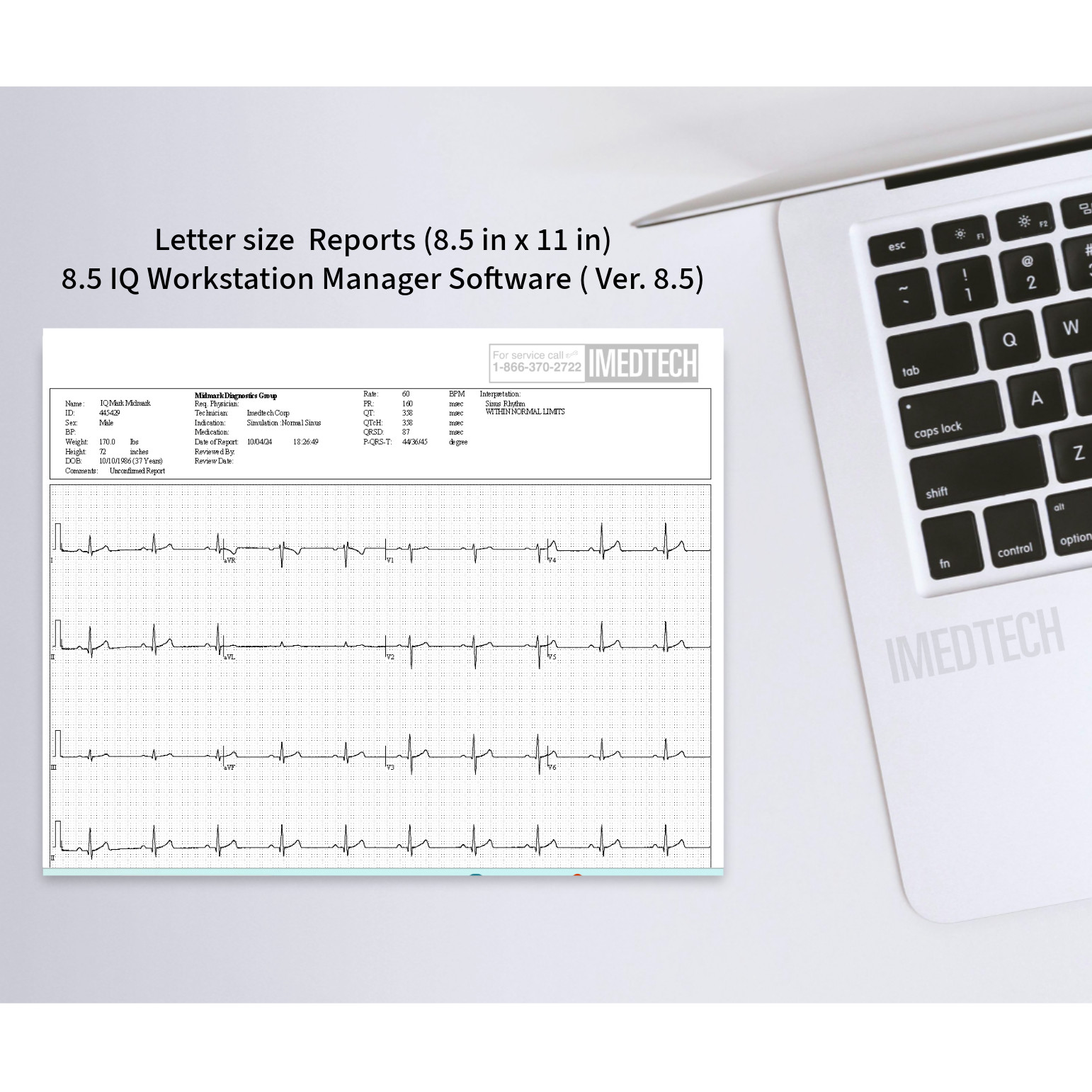 Midmark IQecg ECG Digital Interpretative eClinicalWorks Integration