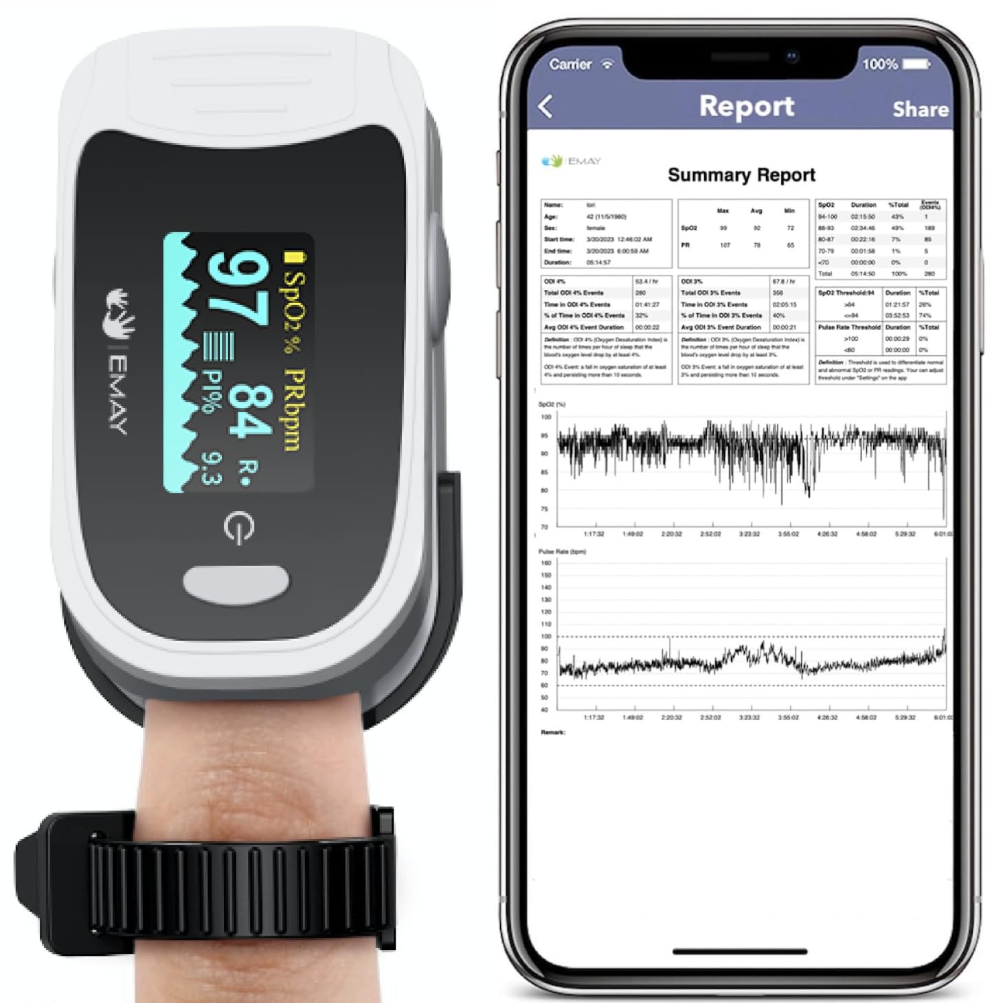 EMAY Sleep Oxygen Monitor with Built-in Recording Capability | Track Grey