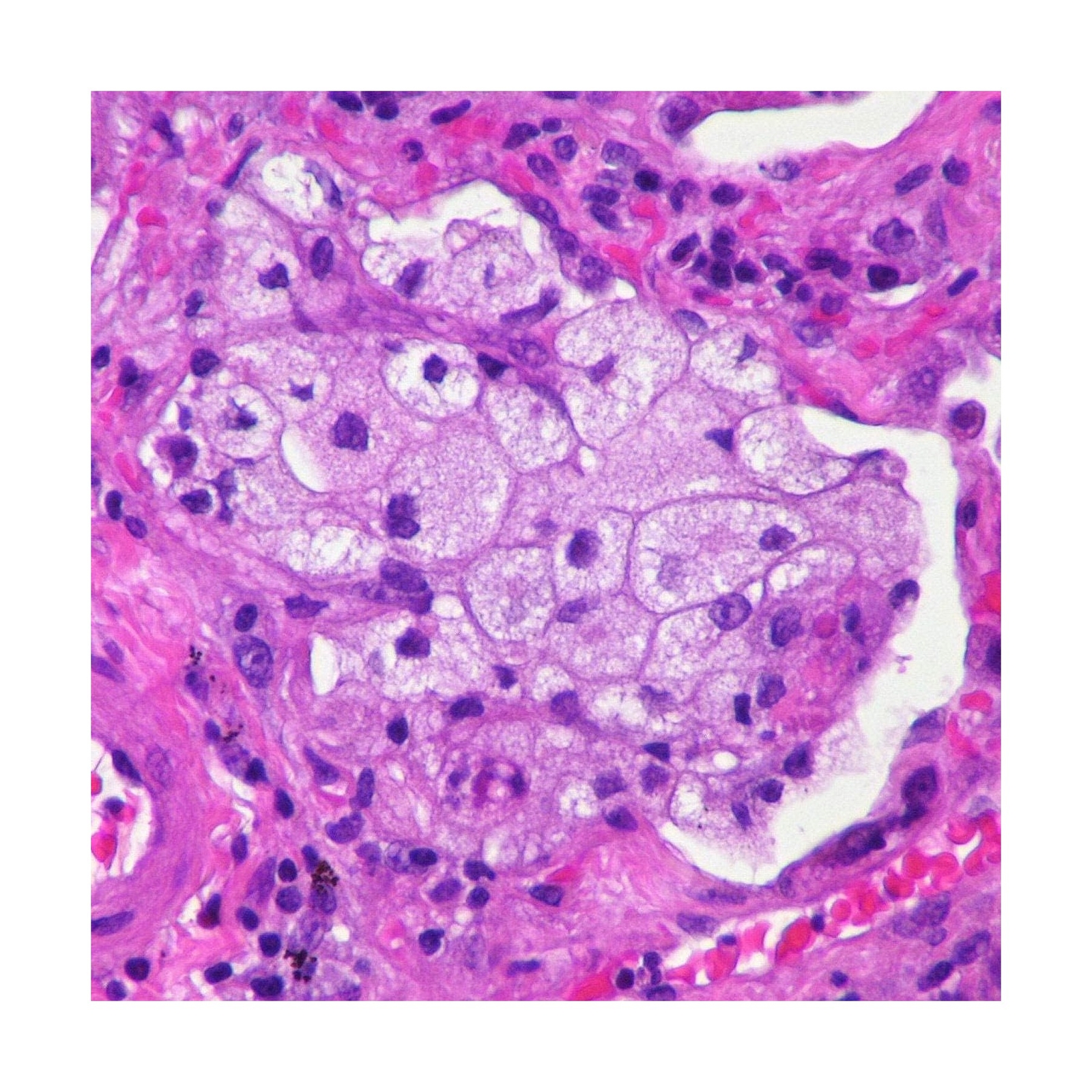 100-Set Prepared Microscope Pathology Slides for Human Medical Education