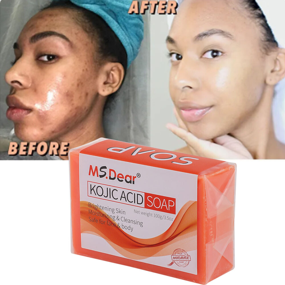 5/3X Kojic Acid Soap Acne Dark Spot Remover Skin Lightening Whitening Face Body