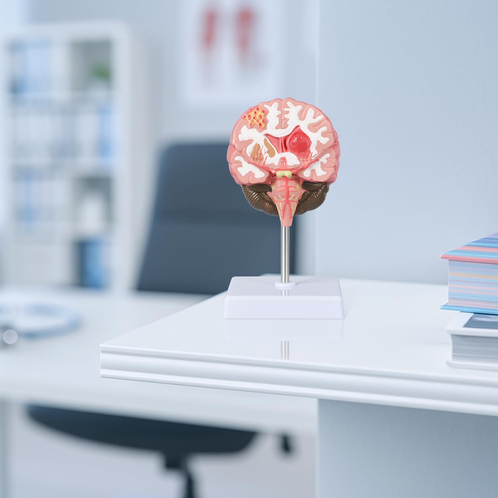 Brain Stroke Anatomy Model, Life-Size Human Brain Structure Anatomical Model,...
