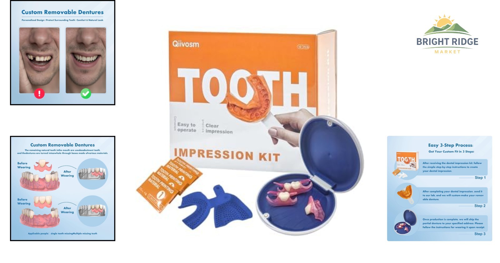 Natural-Looking Partial Dentures for Two Teeth with Easy Maintenance Case