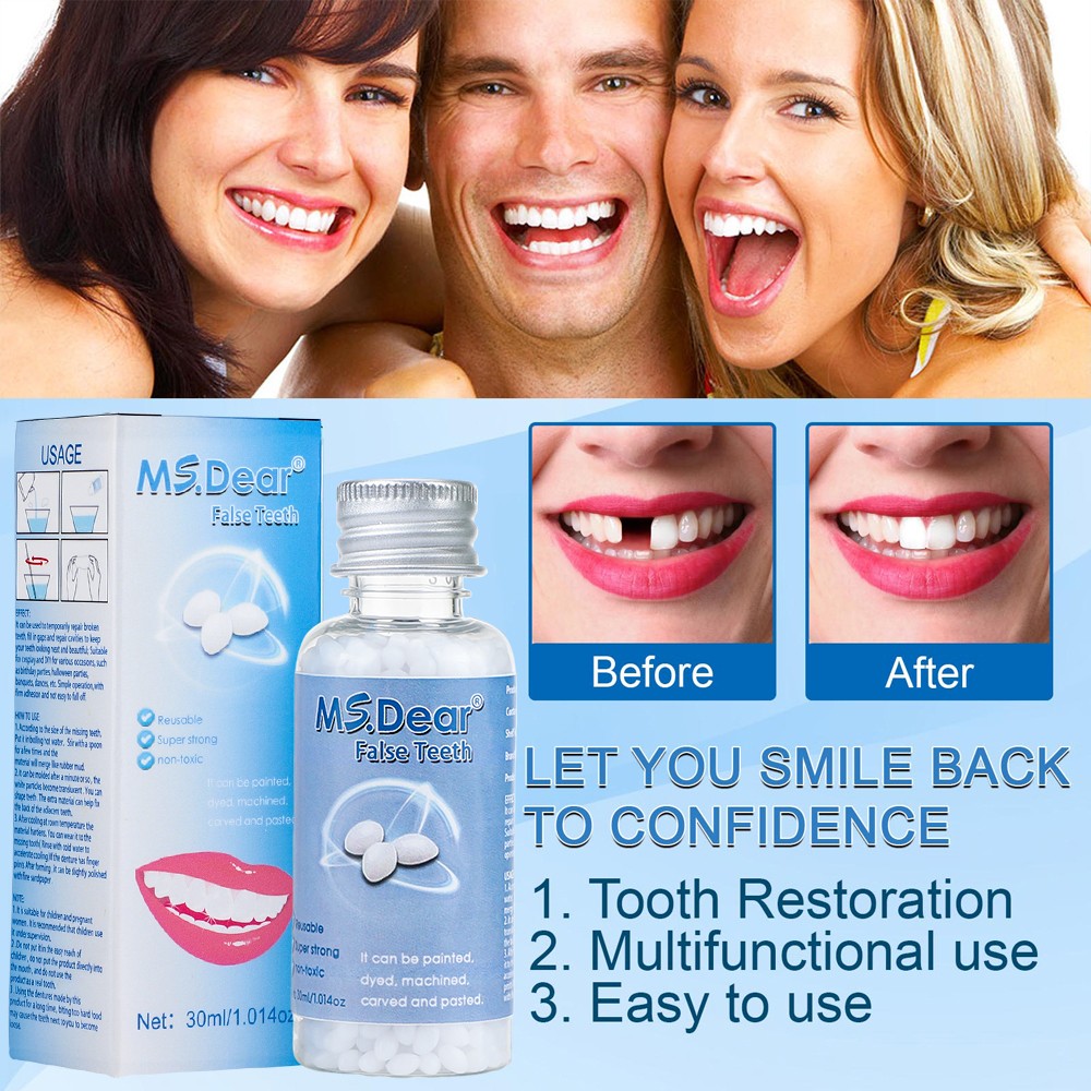 3X Tooth Repair Kit - Temporary Teeth Replacement Kit for Missing & Broken Teeth