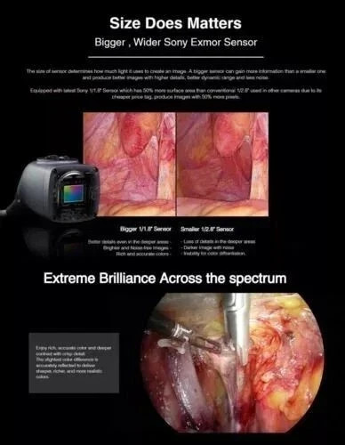 Full HD Endoscopy Laparoscopic Camera for Medical Rigid Endoscope
