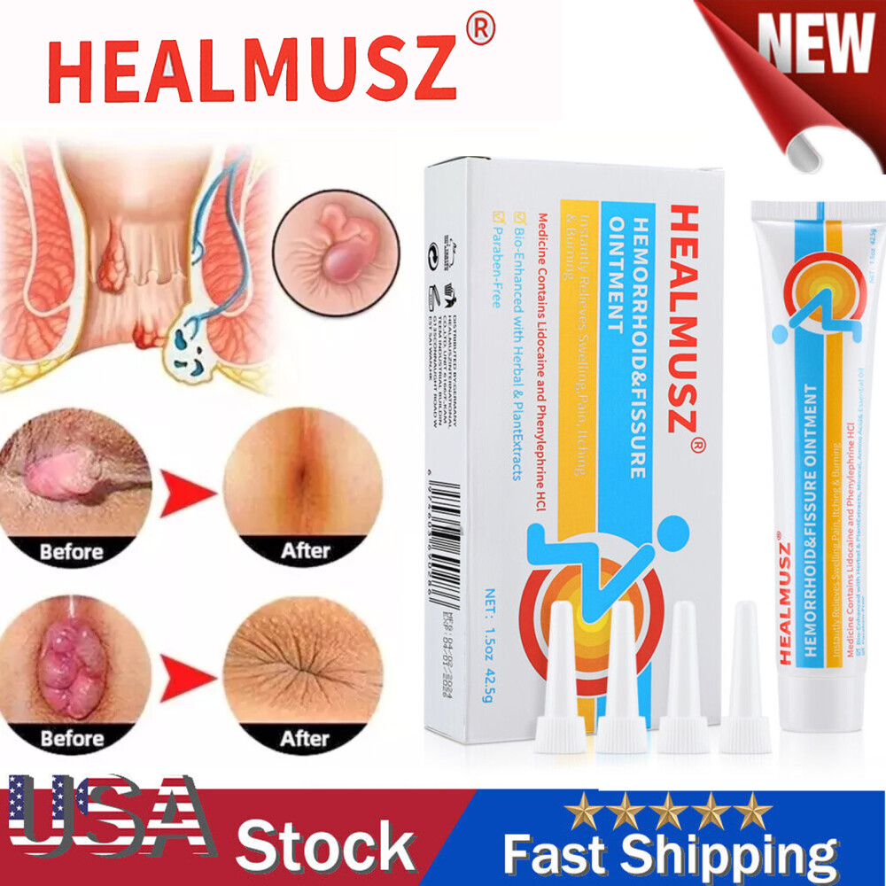 42.5g Hemorrhoids Cream Haemorrhoids Pain Piles Anal Fissure Prolapse Cream Gel