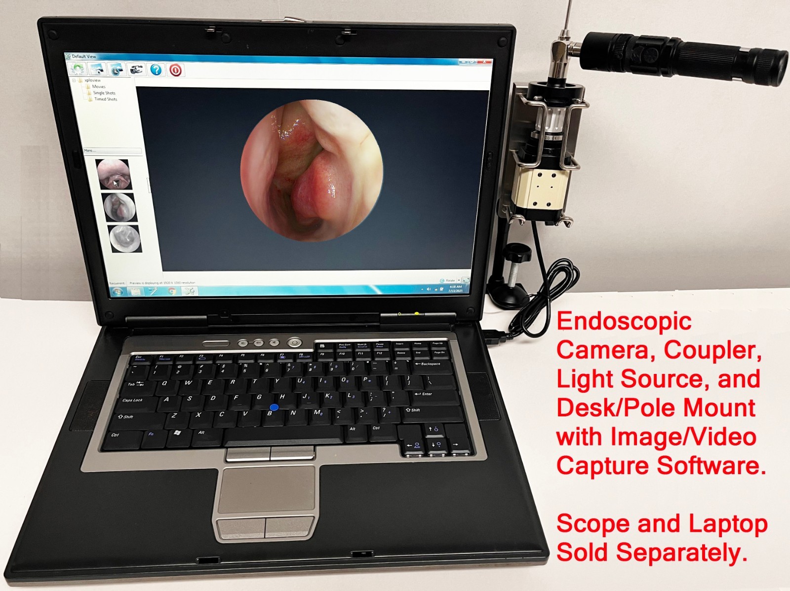 Rigid Endoscope Endoscopy Veterinary HD USB Camera+Coupler+Light Source+Mount