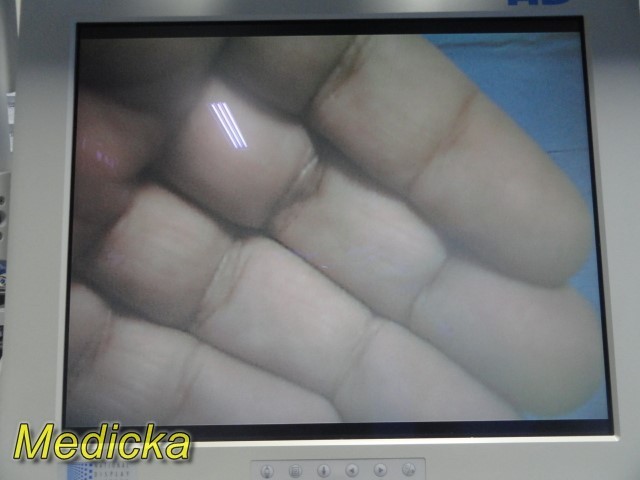 Smith & Nephew DYONICS ED-3 Camera Head W/ Coupler Ref 7204823 | TESTED ~ 37754