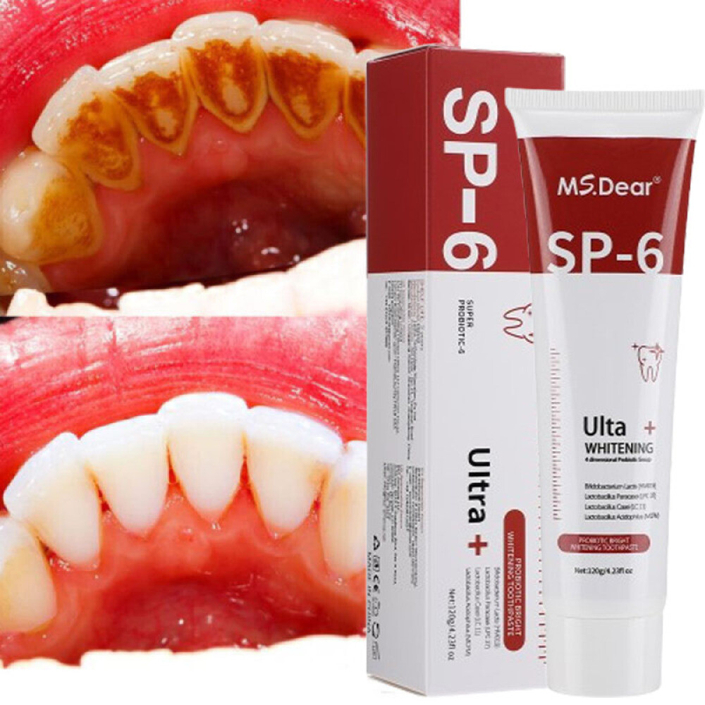 Sp-6 Probiotics Whitening Toothpaste Brightening & Breath Removing Toothpaste US