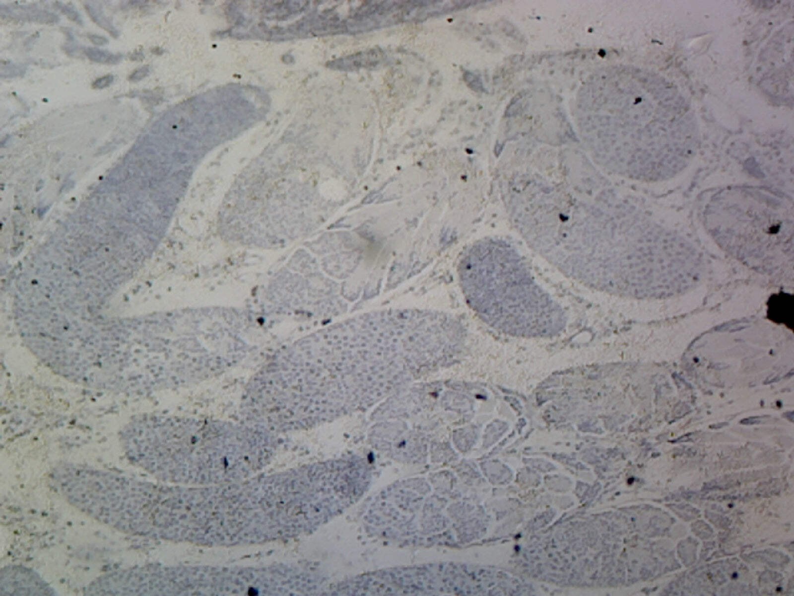 Grasshopper Testis; Whole-mount; IH Stain