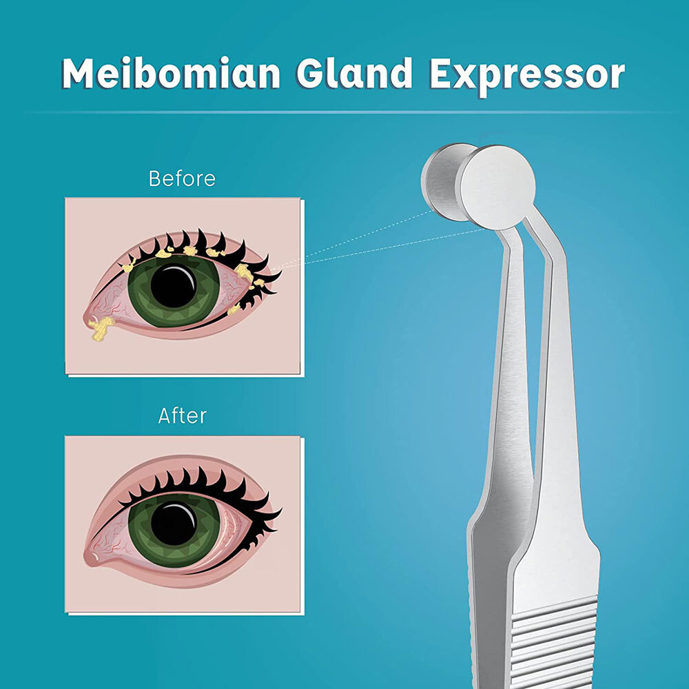 Stainless Steel Meibomian Gland Expressor Forceps Tweezers, Safe USA NEW