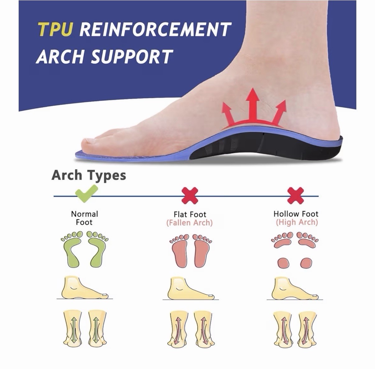 TYMTEEC Extra Support Professional Advanced Insoles Large For All Show Types