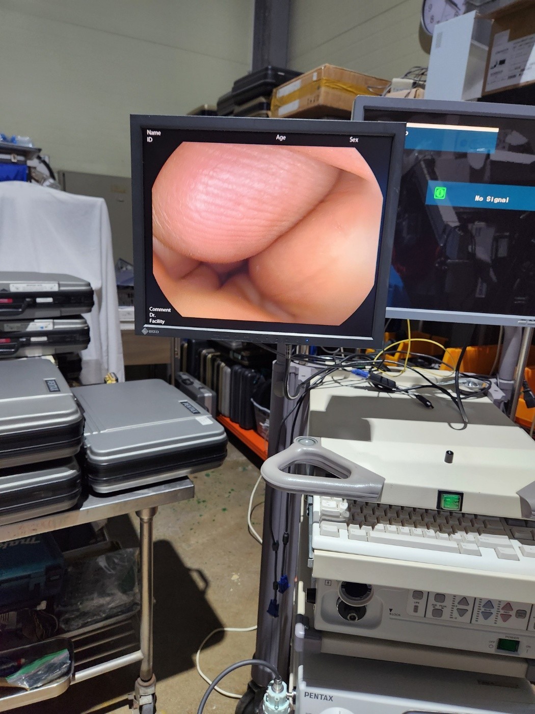 Pentax EPK-i7000 HD Endoscopy System