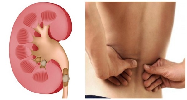 Kidney Flush - KIDNEY SUPPORT - Bladder Health - Kidney Boost - 2 B 120 Ct
