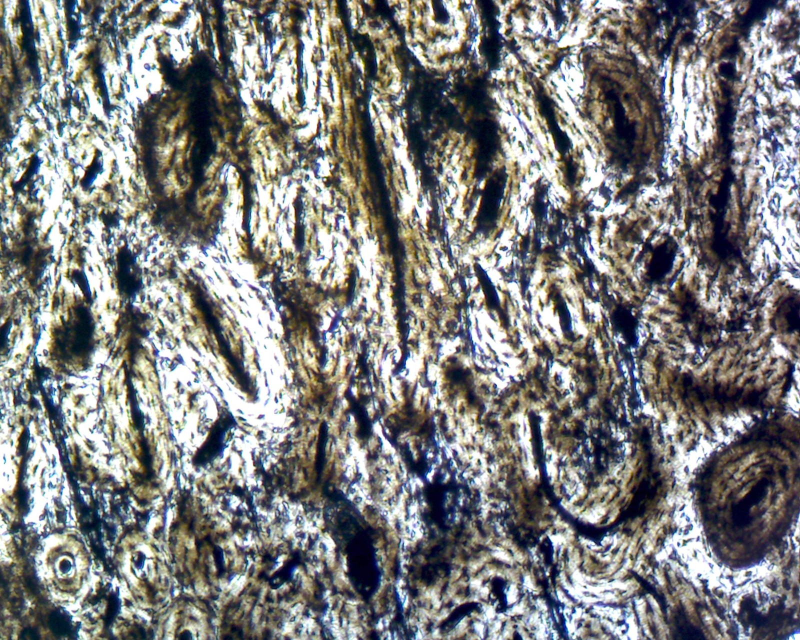 Compact Bone; Ground