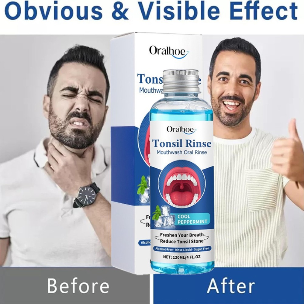 Tonsil Stone Mouthwash, Natural Oral Rinse for Bad Breath & Bad Breath Treatment