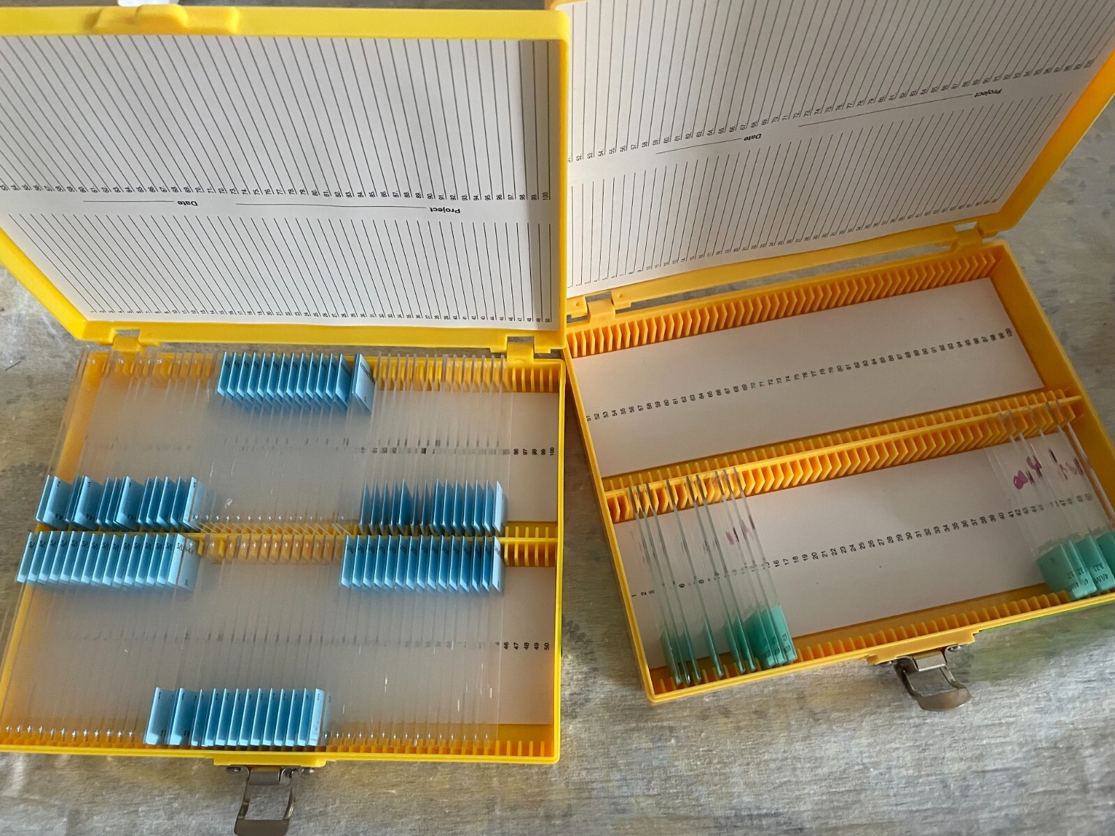 Two Microscope storage boxes with mouse tissues slides