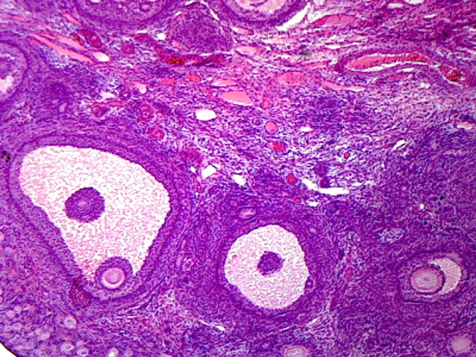 Mature Ovary, Mammalian; Showing General Structures; Section; M Stain