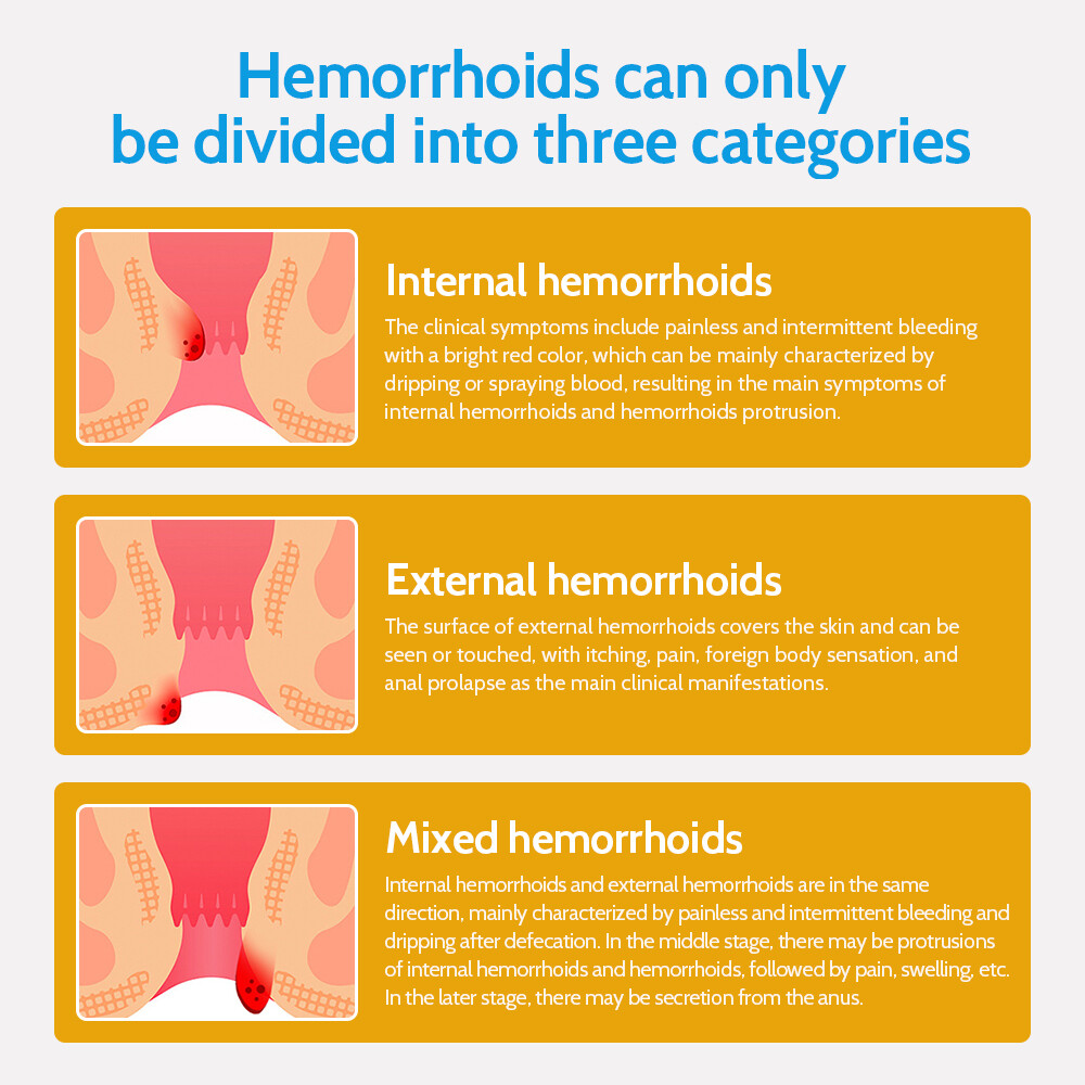 HEALMUSZ Natural Herbal Hemorrhoid Cream,Analysis Internal & External Pile Cream