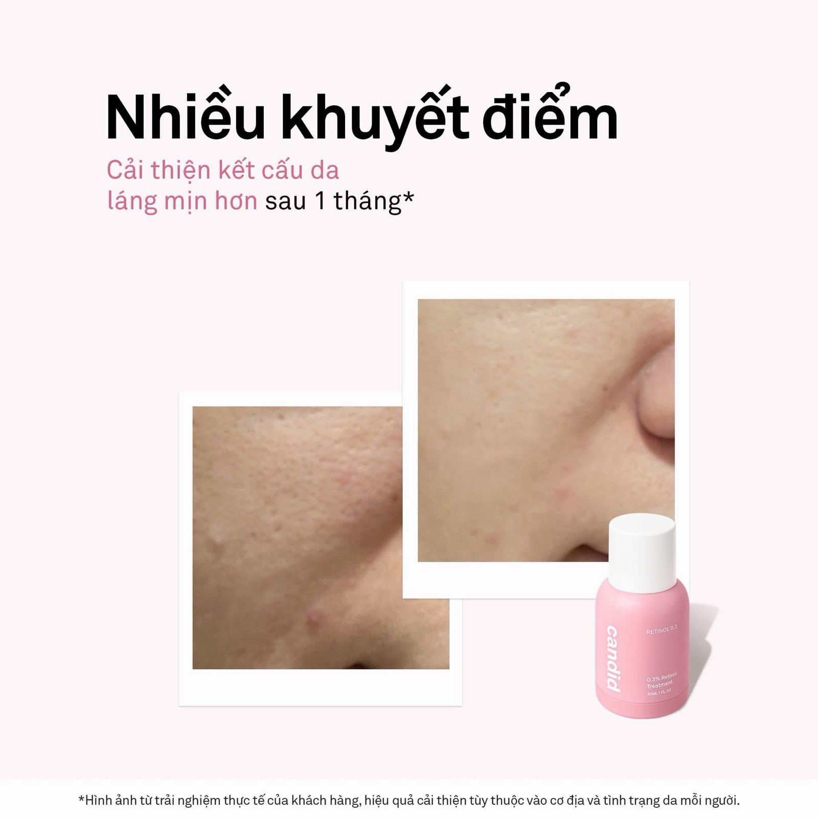 candid Retinol 0.3 Age-Defying Brightening serum Face Treatment (U.S. seller)