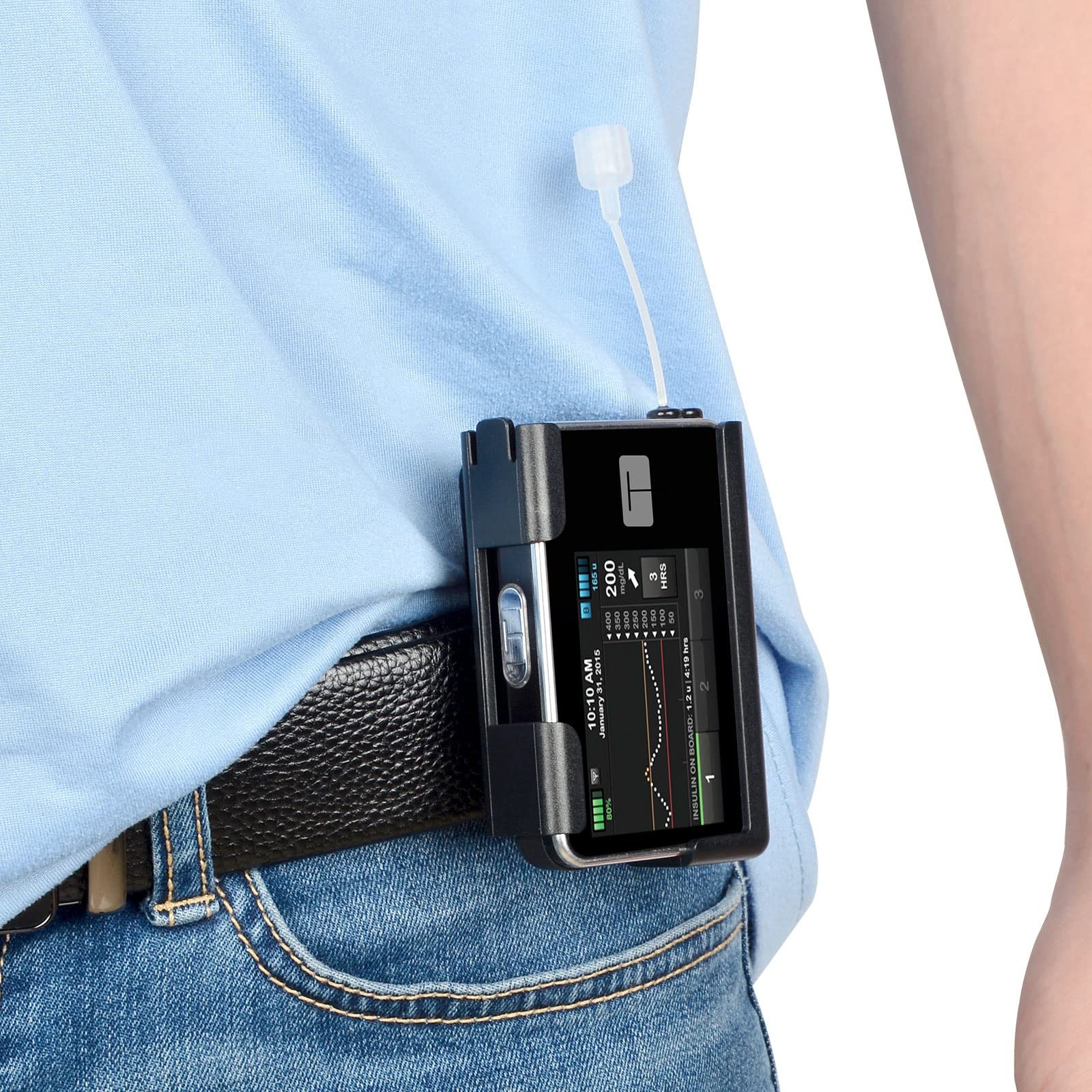 iGuerburn 360° Rotating Case for Tandem tslim X2, Insulin Pump Holder Black