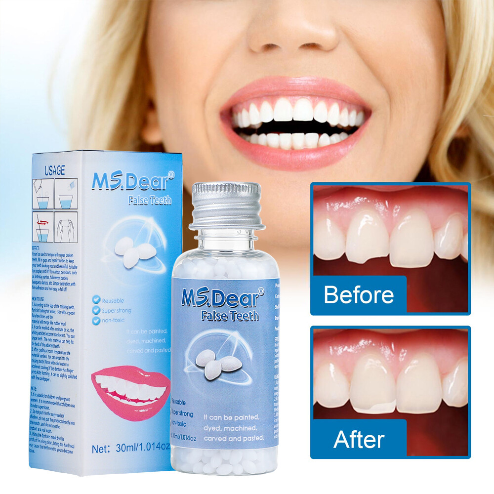 False Teeth Solid Glue Temporary Tooth Repair Set Teeth And Gap Adhesive Tool