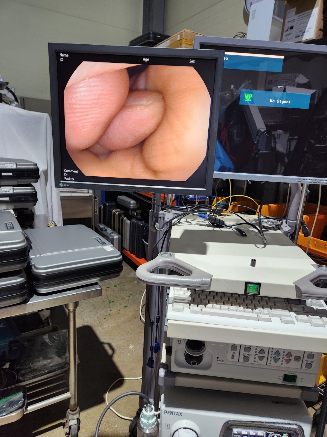Pentax EPK-i7000 HD Endoscopy System