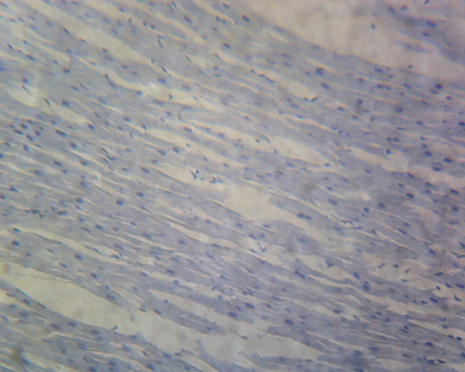 Cardiac Striated Muscle, Longitudinal Section, Mammal.