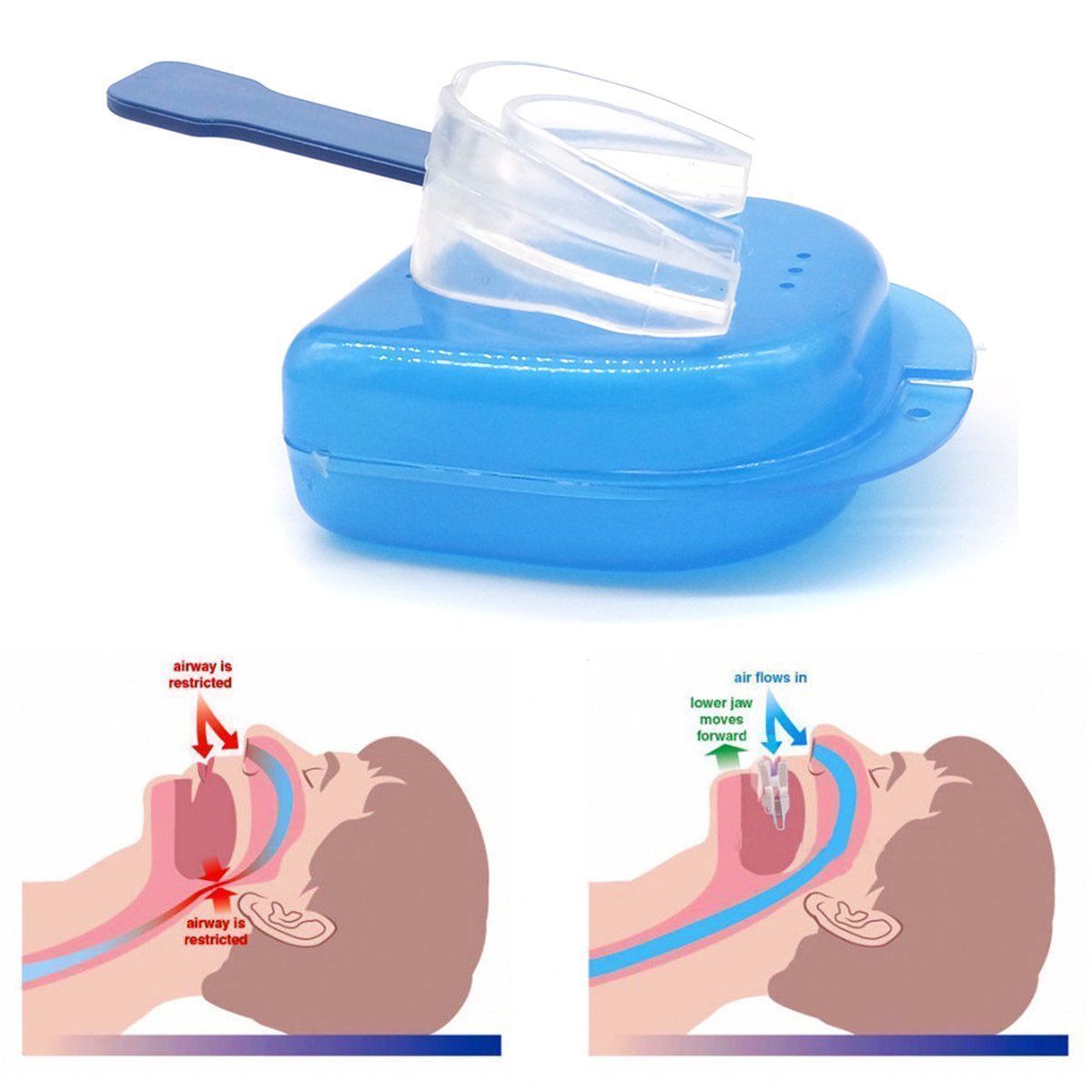 Pure Quiet Sleep Stop Snoring Device Mouthpiece Solution Guard Apnea Moldable