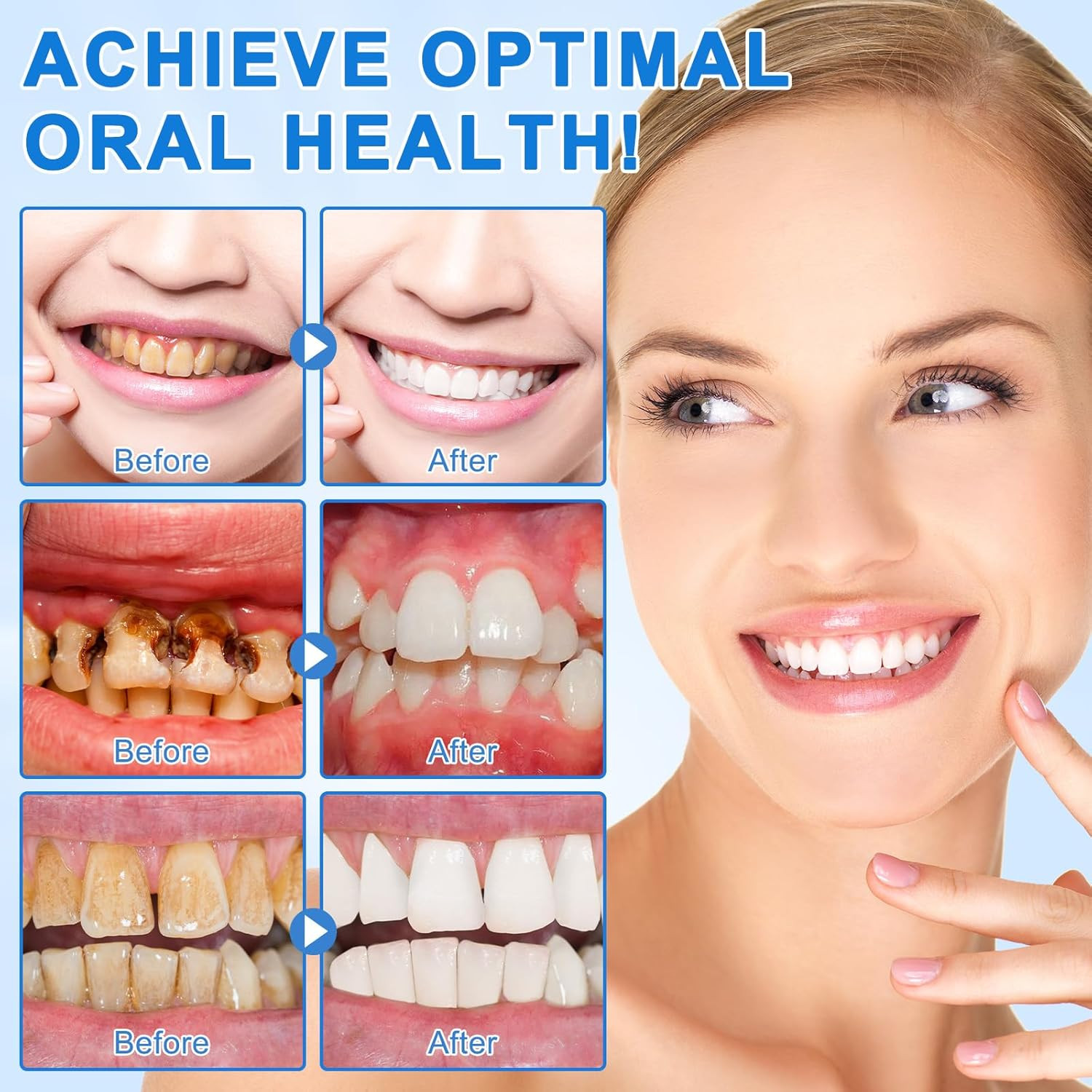 Hydroxyapatite Toothpaste 9.9%, Nano Hydroxyapatite Toothpaste (Fluoride Free...