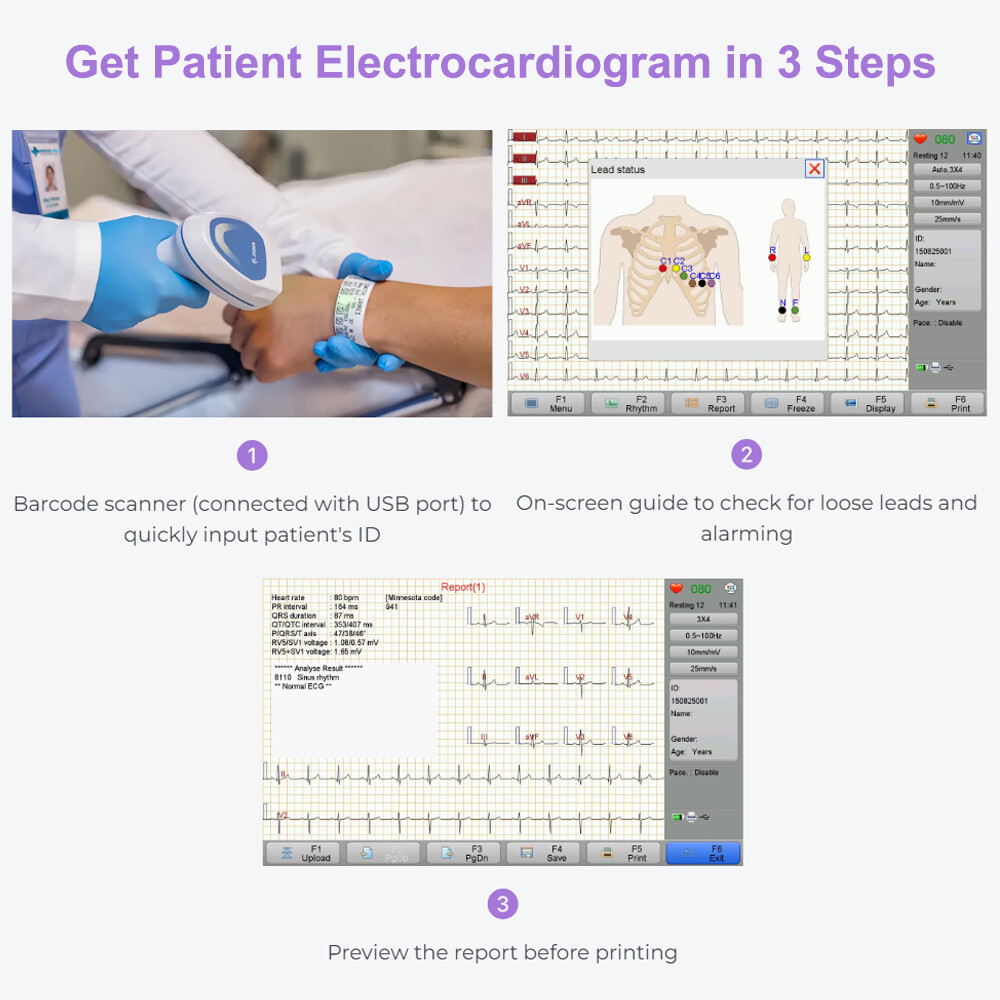 12 channel ECG Machine with interpretation for advisory diagnosis FDA approved