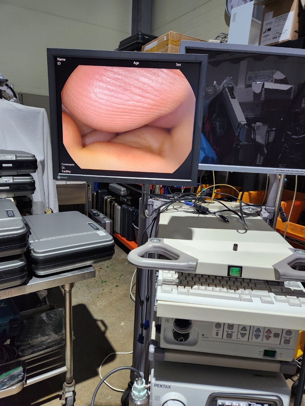 Pentax EPK-i7000 HD Endoscopy System