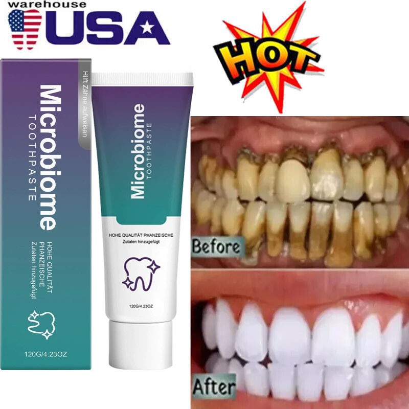Microbiome Mint Flavor Gum Toothpaste Cleaning Toothpaste Sensitive Teeth 120g