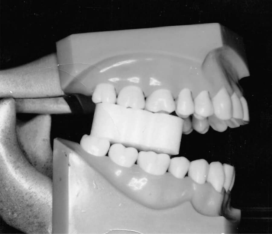 EZ Prop ­® Disposable Mouth Prop - 100 Count