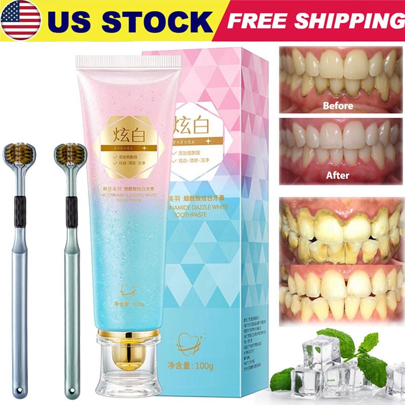 Niacinamide Whitening Toothpaste,Natural Niacinamide Toothpaste,Teeth Whitening