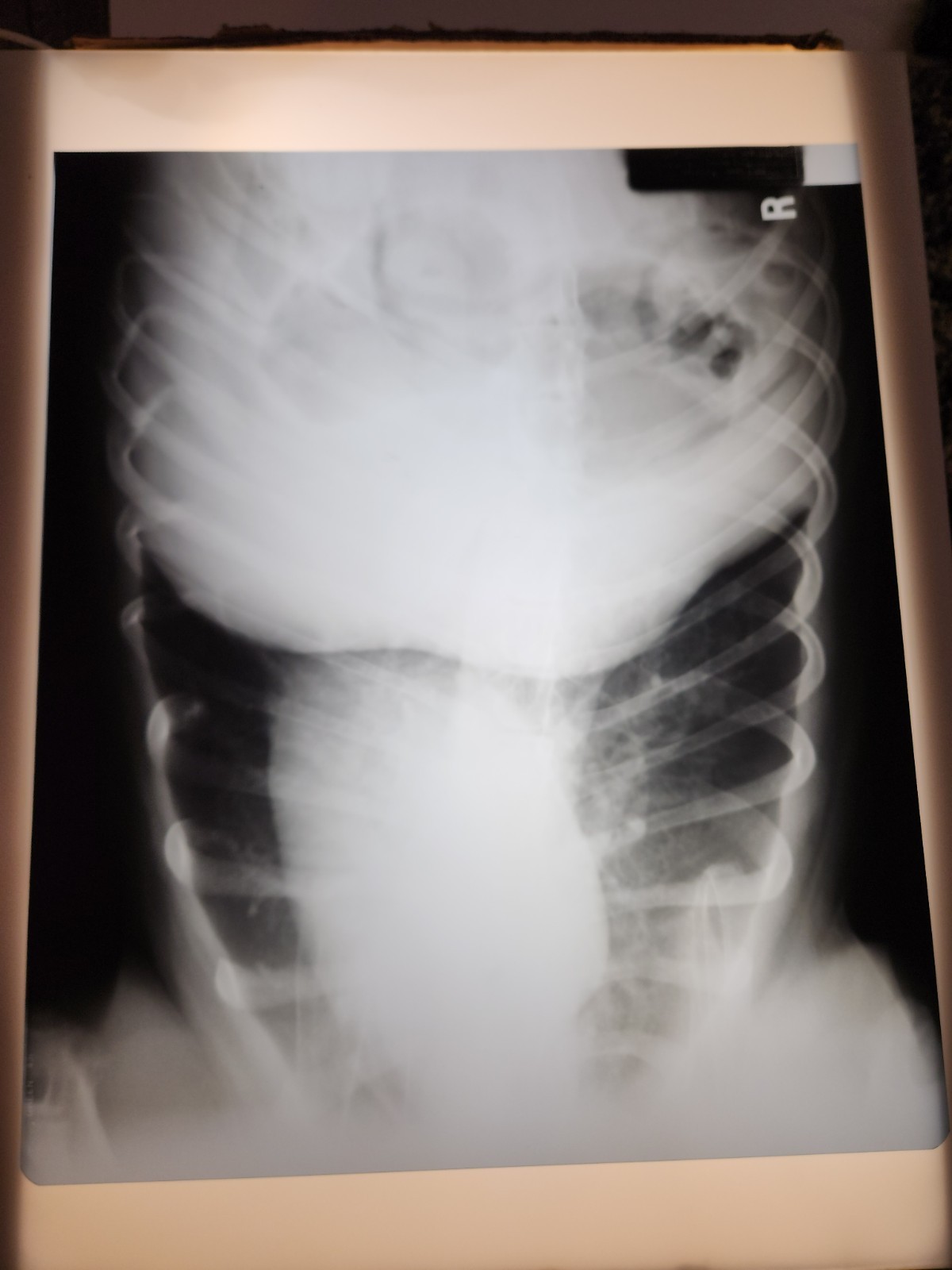 Animal X-Ray Film Negative Print – Canine Dog 16 ½” x 14" XRay Medical Bones D08
