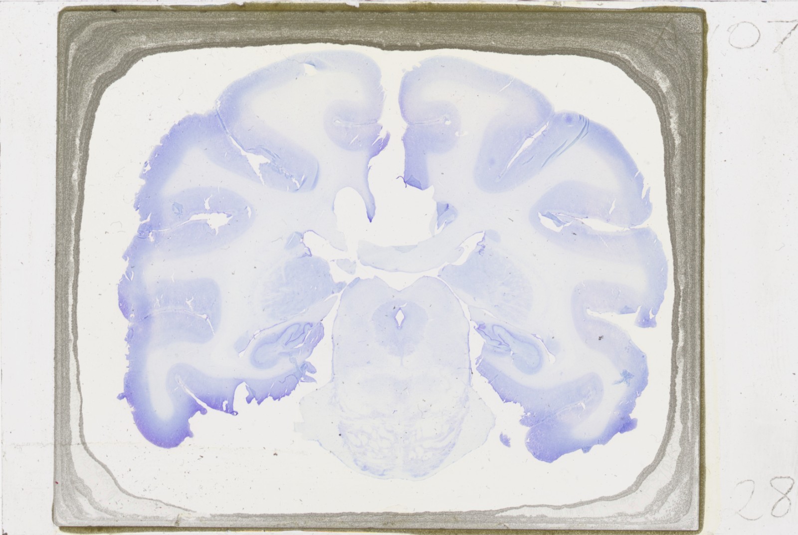 Rhesus Monkey Brain Oversized Microscope Slide - Free worldwide shipping!