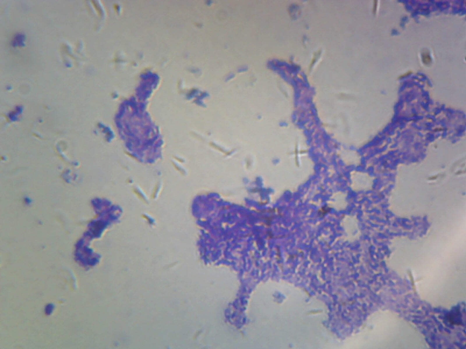 Bacillus; Smear; Gram-Positive