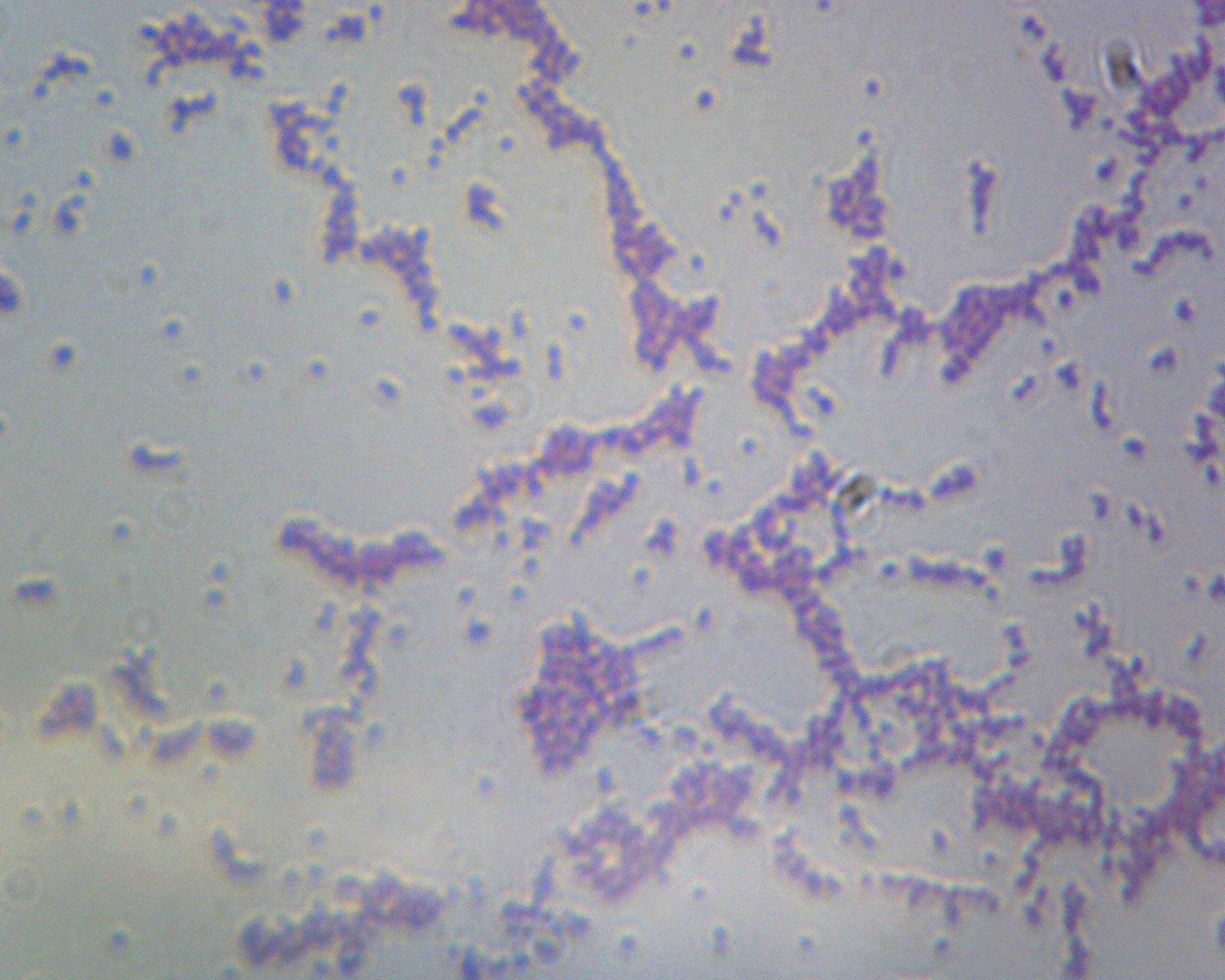 Bacillus; Smear; Gram-Negative