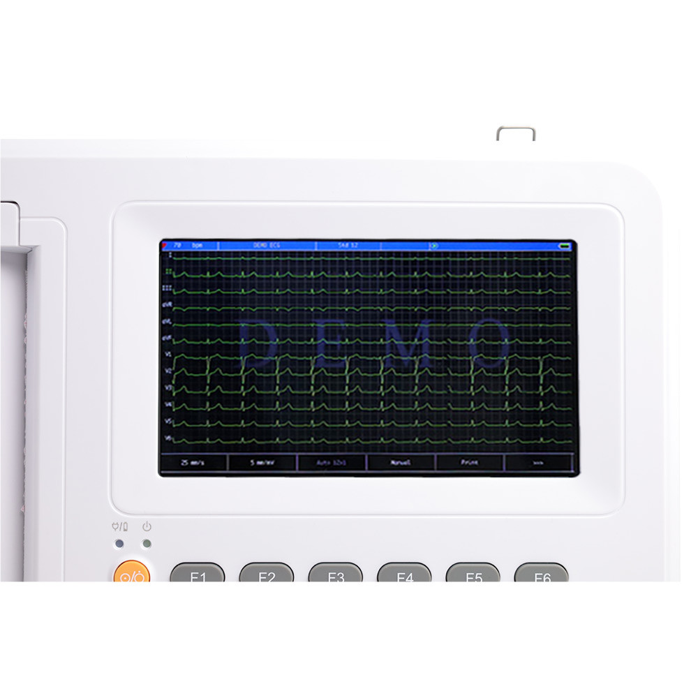 Portable 12-Lead ECG Machine w printing & interpretation for Professional Usage