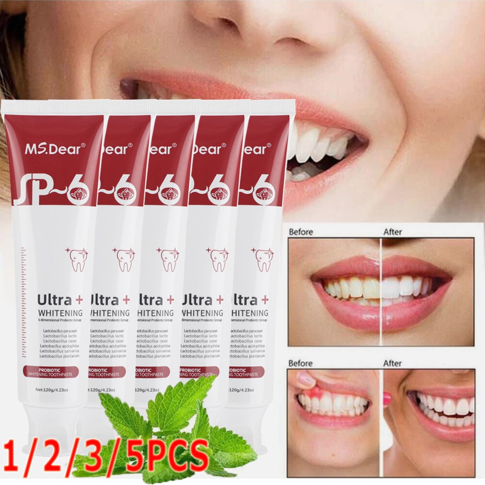 2026 Whitening Teeth Probiotics Breath Removing Toothpaste SP-6 Refreshing Teeth