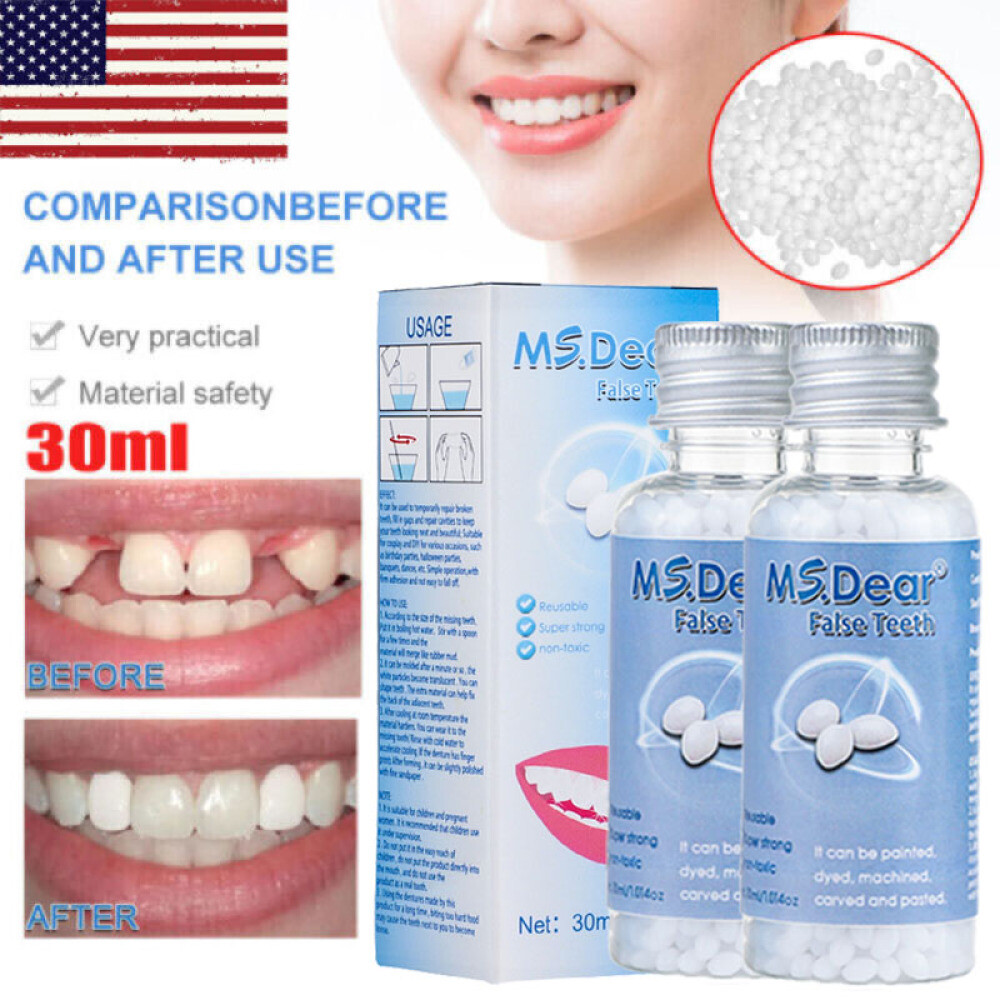 2X Tooth Repair Kit - Temporary Teeth Replacement Kit for Missing & Broken Teeth
