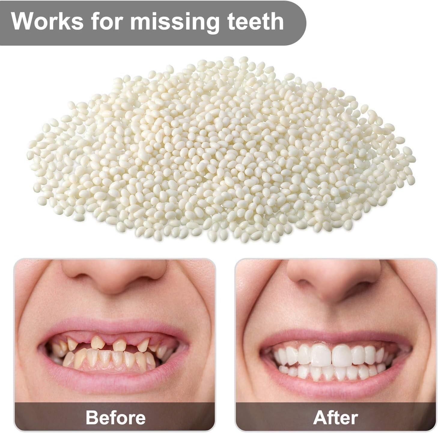 100G Bead Teeth Tooth Solid Gel Replacement Moldable Thermal Fitting Bead Teeth