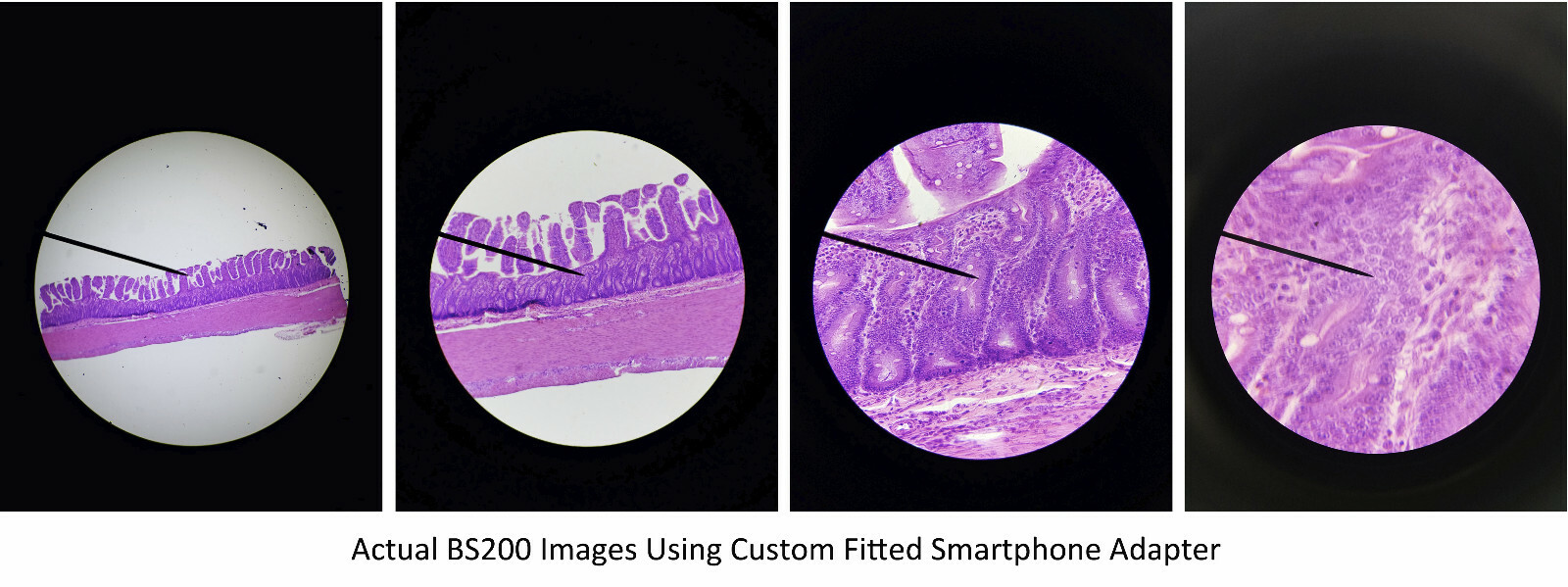 Microscope Eyepiece Camera Adapter for Smartphone & iPhone + 10x 20mm Oculars