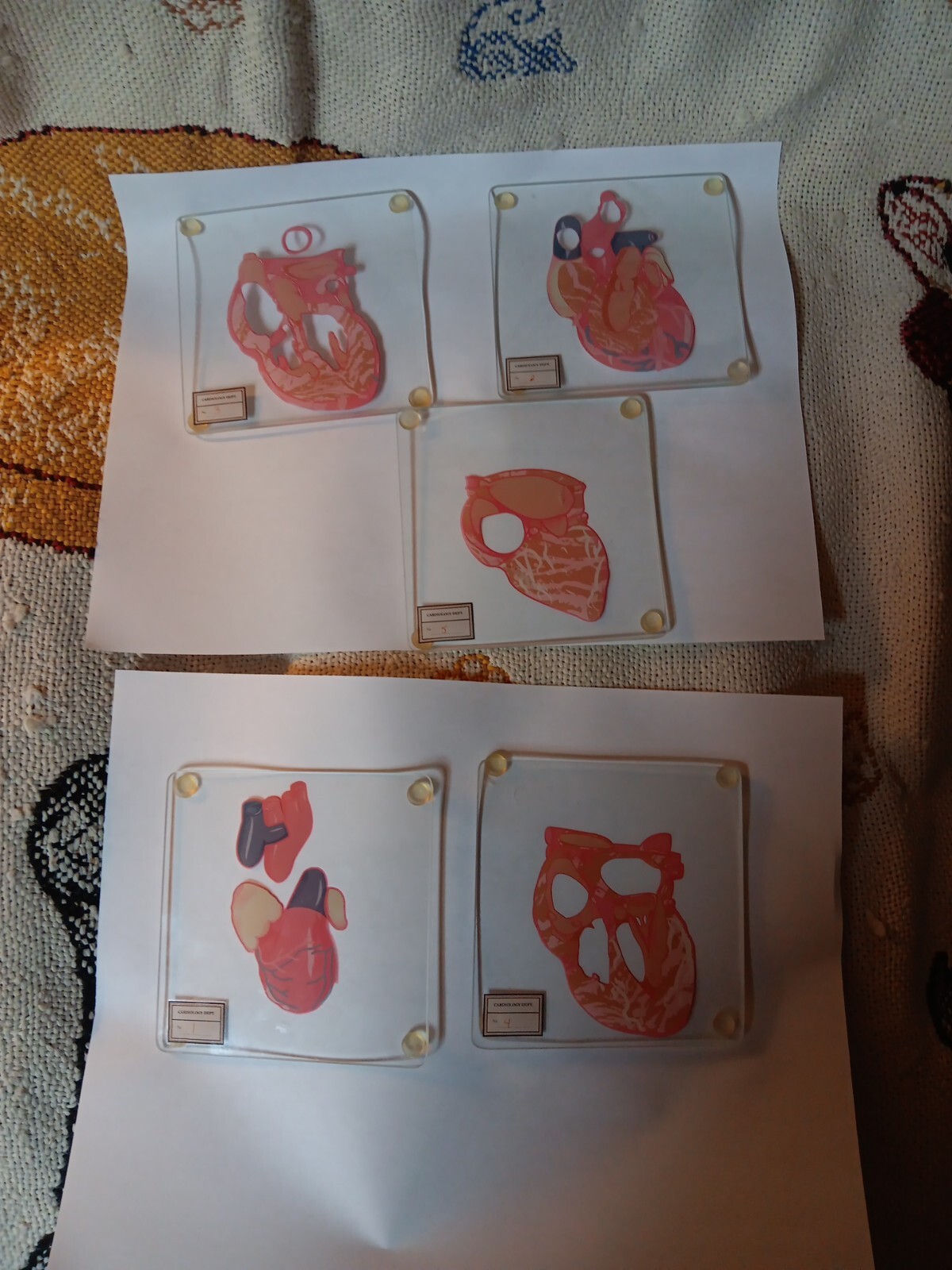 Lot 5 Glass Cardiology Dept. Slides Stacking Human Heart Medical Ephemera