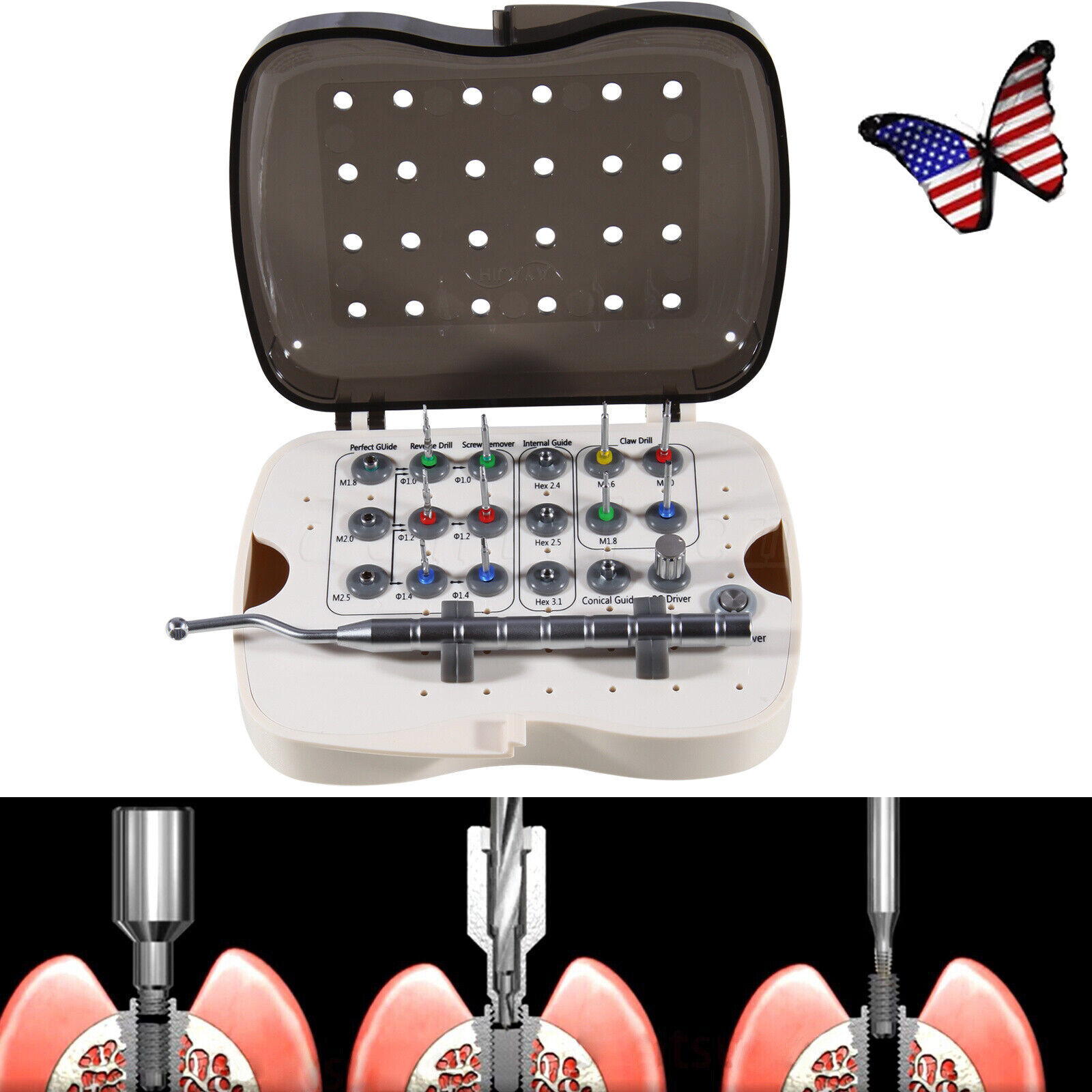 Broken Screw Removal Kit Implant Screw Remover Tool Universal NeoBiotech MX