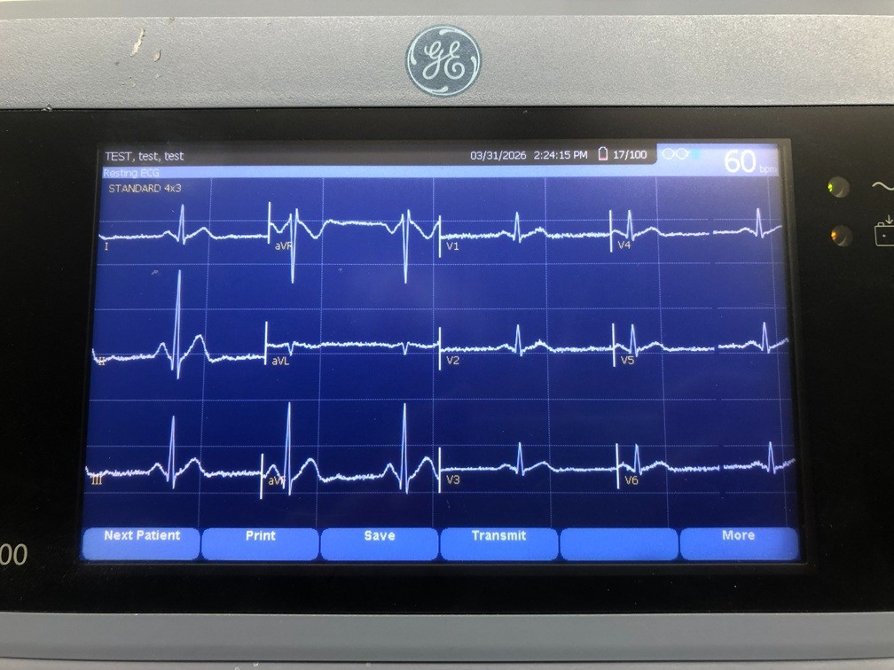 GE MAC 1600 Resting ECG Analysis Machine