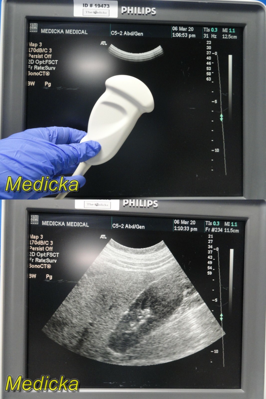 Philips C5-2 40R (4000-0574-06) Curved Array Ultrasound Transducer Probe ~ 21278