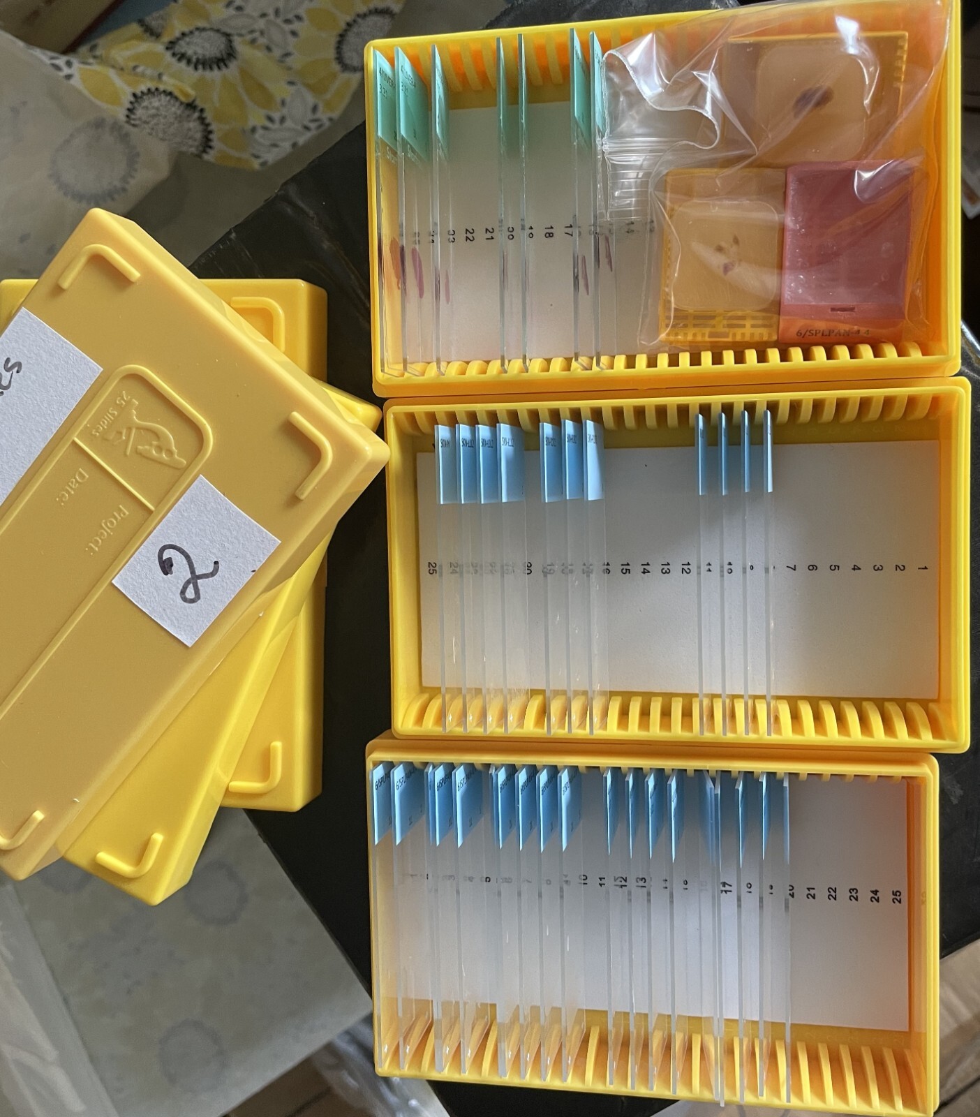 Microscope storage boxes with mouse tissues slides