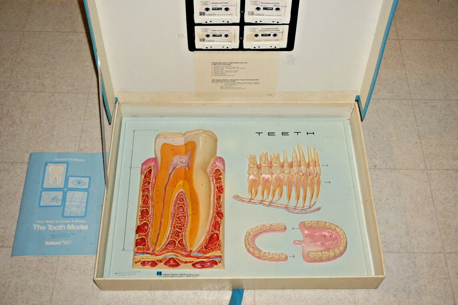 Vintage 1970's Hubbard Scientific 3D Plastic Tooth Display Anatomy Chart Dentist